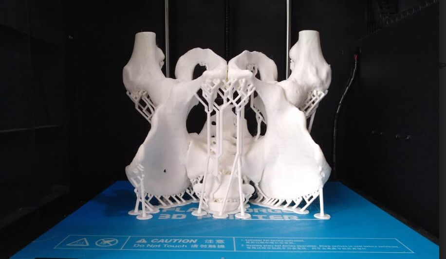 3D打印中樹枝型支撐比一般支撐有什麼優勝之處？