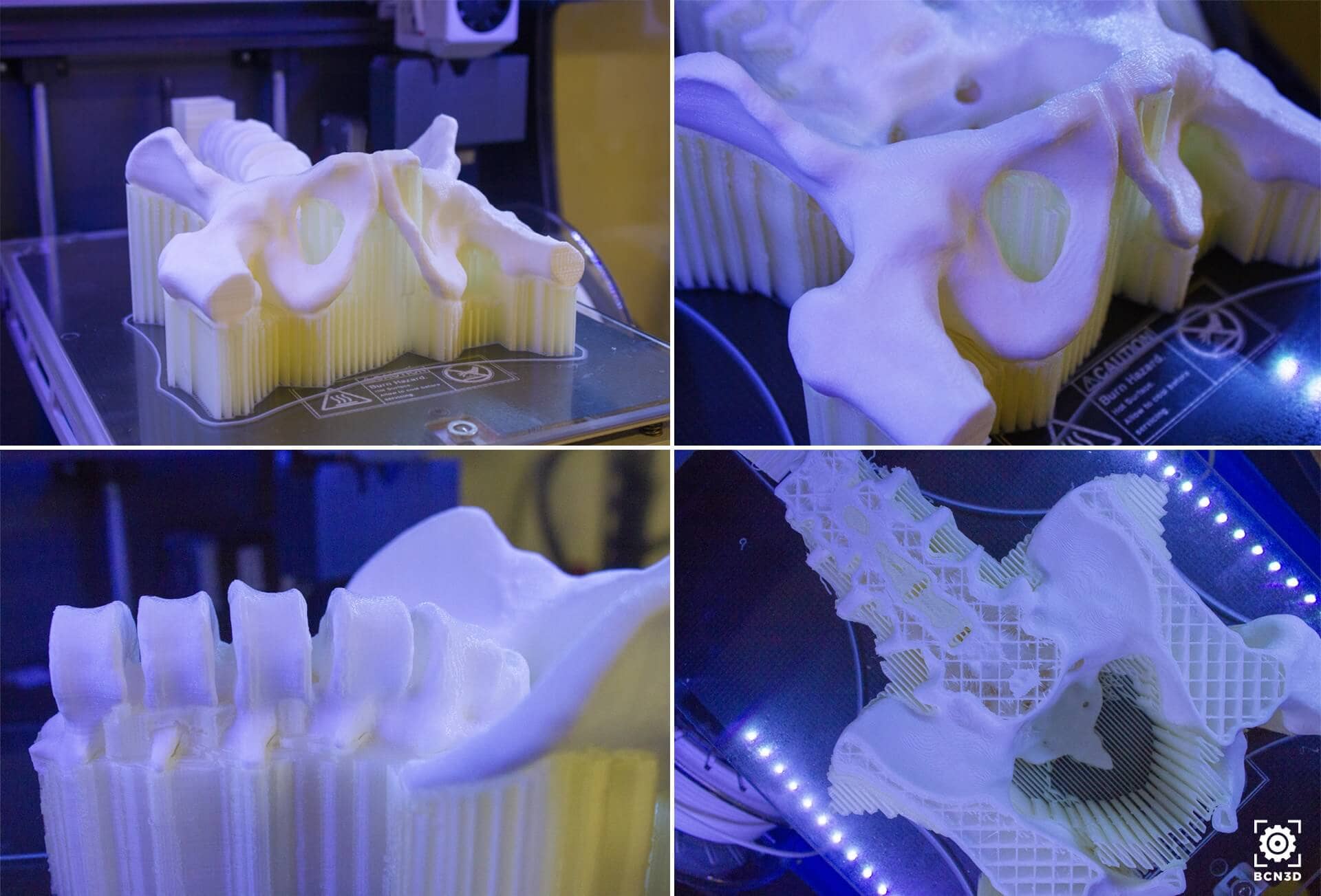 3D打印作為外科醫生的新工作方法