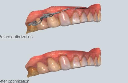 SHINING 3D Aoralscan™牙科口內3D掃描器