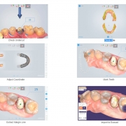 SHINING 3D Aoralscan™牙科口內3D掃描器5