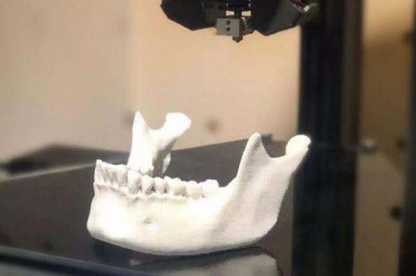 利用3D掃描及打印修復骨頭