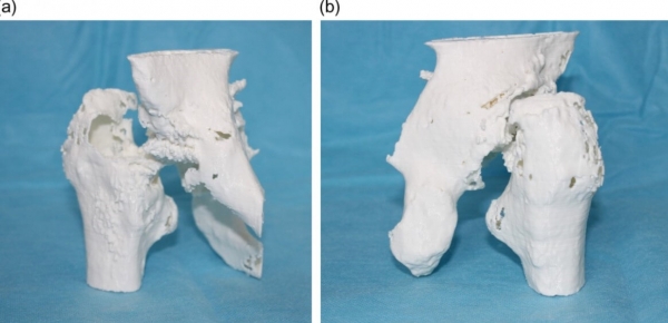 3D打印的醫學模型和儀器，在肌肉骨骼應用中的影響持續增長