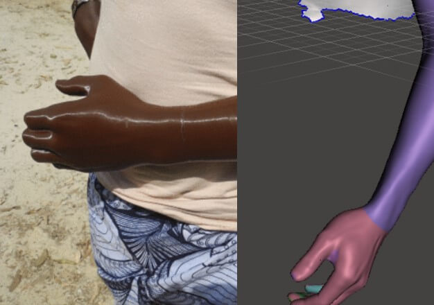 3D掃描在非洲怎樣協助製作醫療輔助工具？