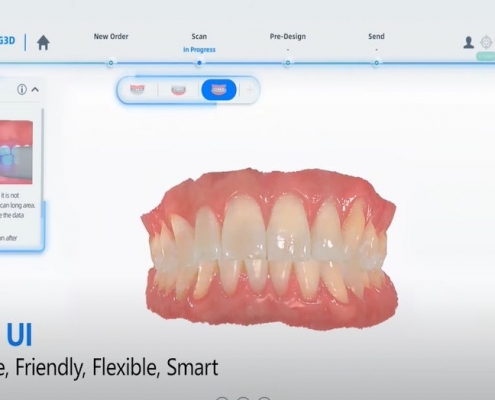 給牙醫使用的手提及固定式3D掃描器 1