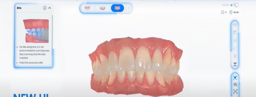 給牙醫使用的手提及固定式3D掃描器 1
