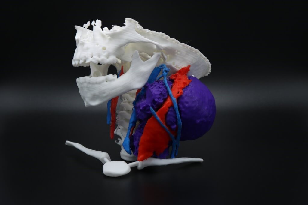 3D 打印之醫療模型及面部義肢
